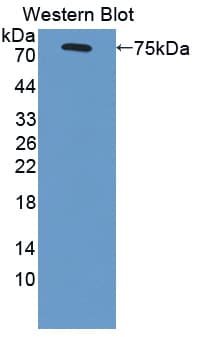 SCARB1 / SR-BI Antibody (aa33-440)