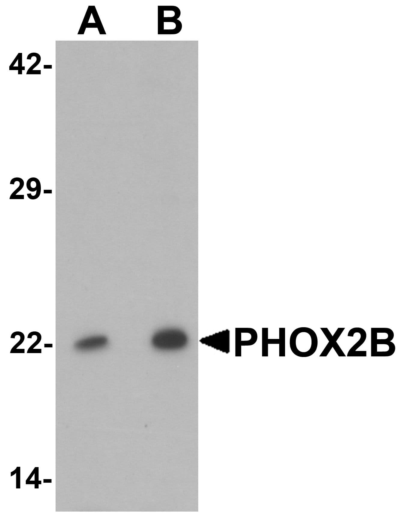Polyclonal Rabbit anti-Human PHOX2B Antibody (WB)