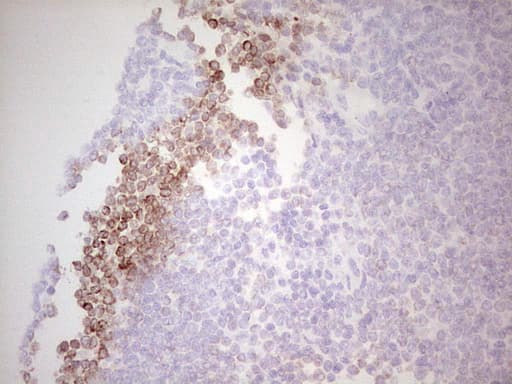BCL2 / Bcl-2 Antibody (clone OTI3H10)