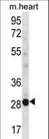 NCCRP1 Antibody (aa246-275)