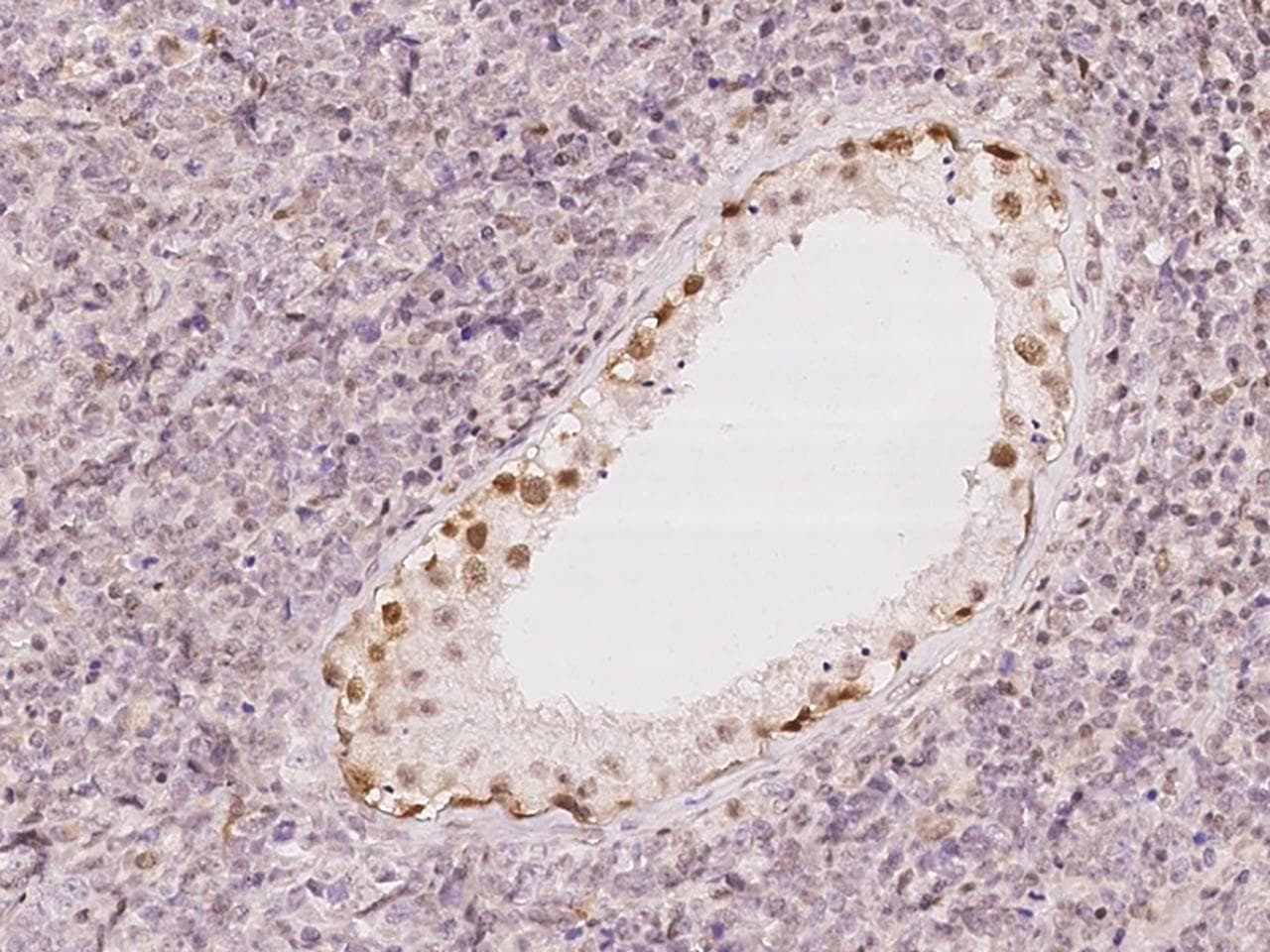 UBLCP1 Antibody
