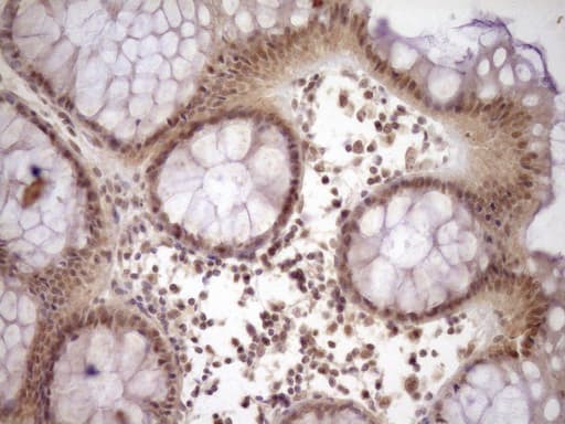 Monoclonal Mouse anti-Human NR2C2 / TAK1 Antibody (clone OTI7E12, aa1-241, IHC, WB)