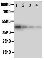 NEP / DDR1 Antibody (aa898-913)