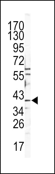PathPlus™ CTSB / Cathepsin B Antibody (aa198-227)