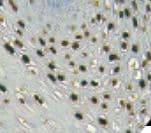 Monoclonal Mouse anti-Human Papillomavirus 16 HPV / Human Papilloma Virus Antibody (IHC)