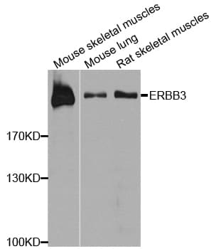 Polyclonal Rabbit anti-Human ERBB3 / HER3 Antibody (WB)