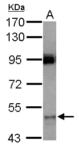 Polyclonal Rabbit anti-Human CYP3A7 Antibody (WB)