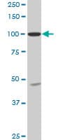 Monoclonal Mouse anti-Human SH3D19 Antibody (clone 5C7, IF, WB)