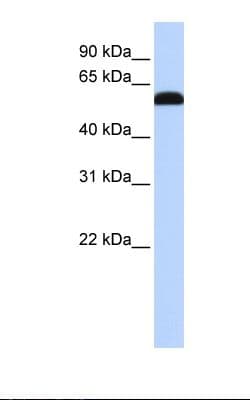 ZGPAT Antibody (aa254-303)
