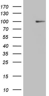 HSF2 Antibody (aa74-324, clone OTI4G9)