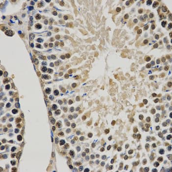 Polyclonal Rabbit anti-Human Histone H3 Antibody (Methyl-Lys9, IHC, IF, WB)