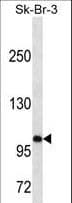 SPN / CD43 Antibody (aa32-60)