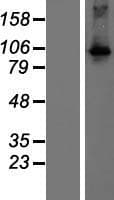 DGKQ Protein (Over-Expression Lysate Myc-DDK (Flag))