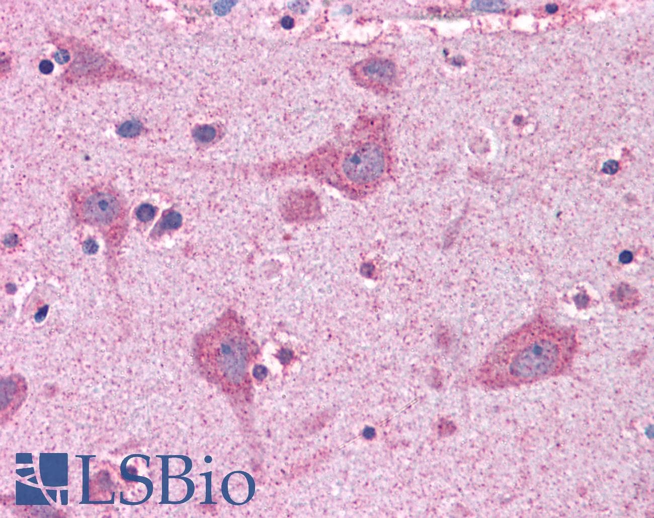 IHC-plus™ ACSL4 / FACL4 Antibody (aa658-670)