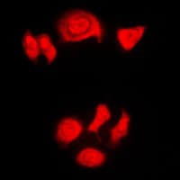 NPM1 / NPM / Nucleophosmin Antibody (phospho-Thr199)