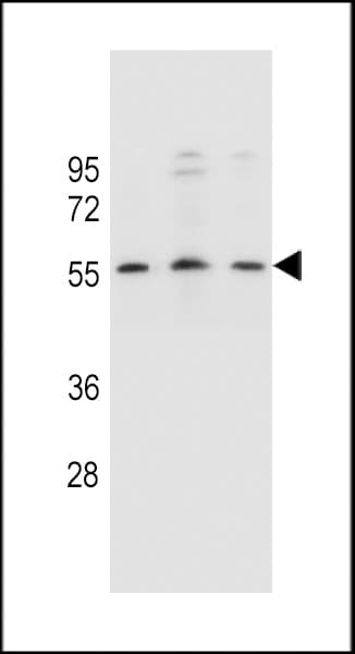 KCNK18 / TRESK Antibody (aa168-197)