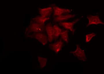 Polyclonal Rabbit anti-Human POM121 Antibody (IF, WB)