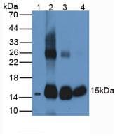 HBB / Hemoglobin Beta Antibody (aa1-147)