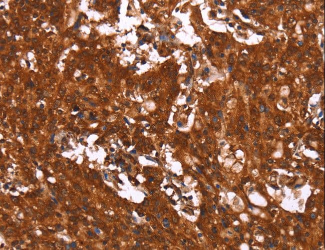 HCAR2 / NIACR1 Antibody