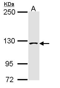Polyclonal Rabbit anti-Human SAP130 Antibody (aa1154-1217, IHC, WB)