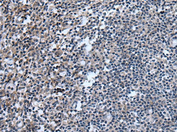UGT8 Antibody