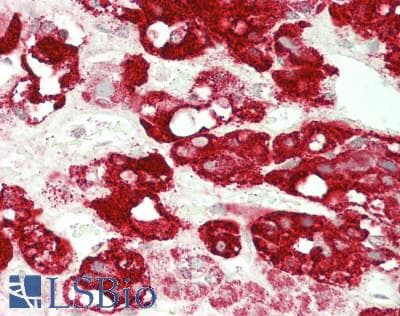 IHC-plus™ PLAGL1 / ZAC Antibody (aa298-347)