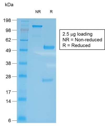 Recombinant Monoclonal Rabbit anti-Human CD27 Antibody (clone LPFS2/2034R, IHC)