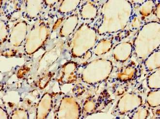 Polyclonal Rabbit anti-Human HDHD2 Antibody (IHC, IF)
