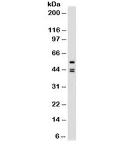 Cytokeratin 8+18 Antibody (clone SPM141, Azide-free, BSA-free)