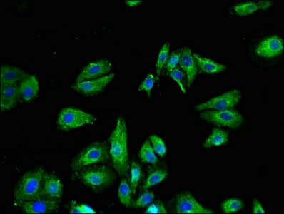 Polyclonal Rabbit anti-Human VR1 / TRPV1 Antibody (IHC, IF)