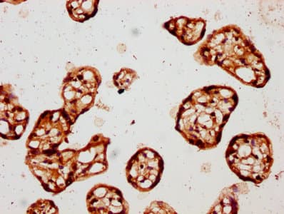 CSNK1E / CK1 Epsilon Antibody