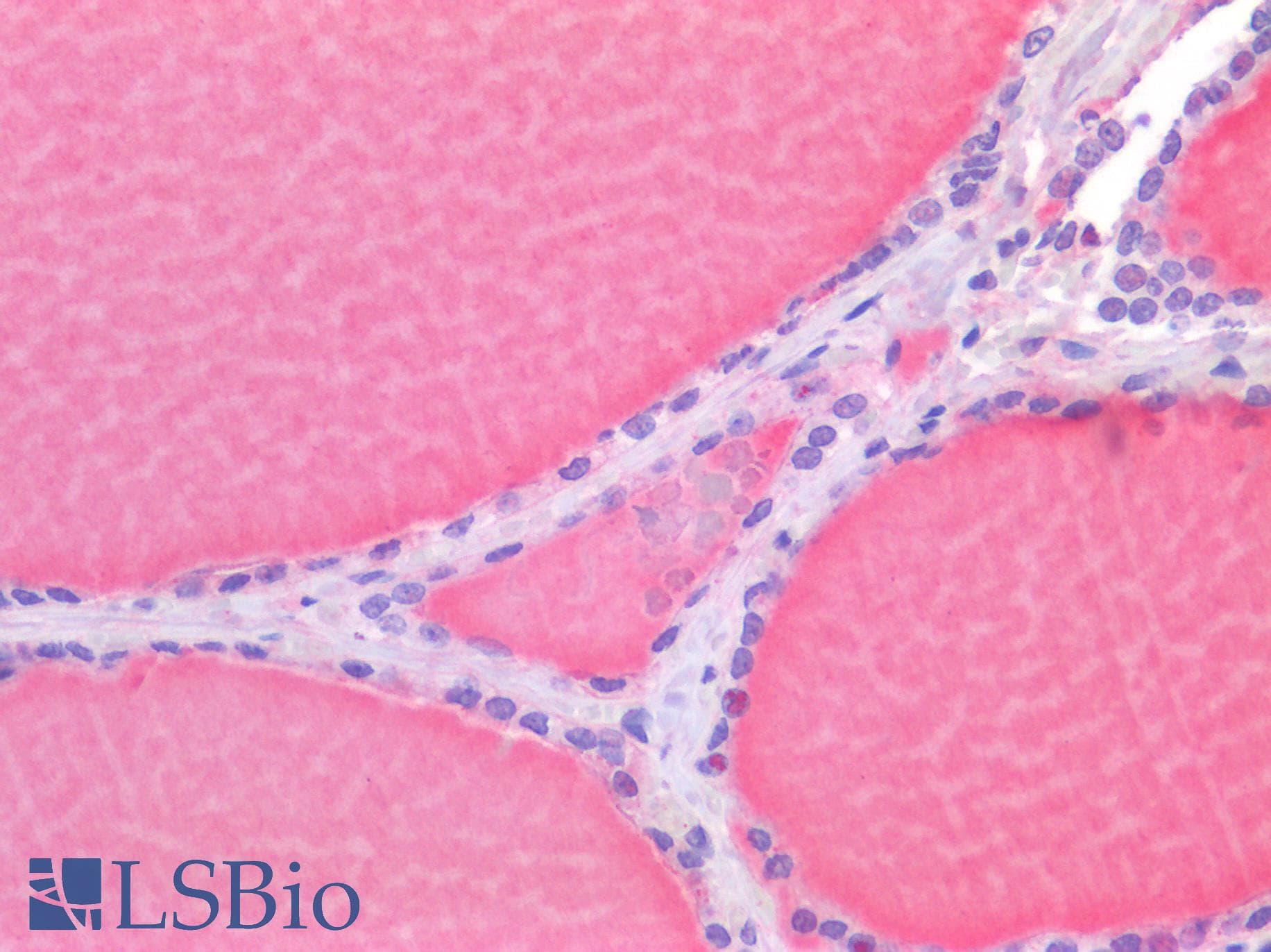 IHC-plus™ RORC / ROR Gamma Antibody (Ligand-binding Domain)
