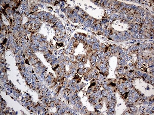 PTPN22 / PEP Antibody (aa359-449, clone OTI6B1)