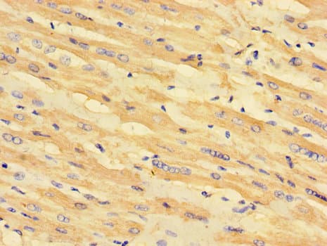 MLYCD / MCD Antibody