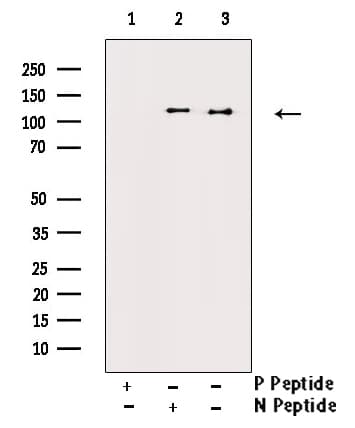 VCL / Vinculin Antibody (phospho-Tyr821)