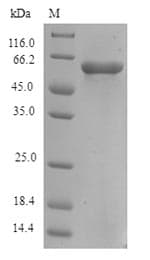 Human FAM46C Protein (Recombinant 6His-SUMO, N-terminus)
