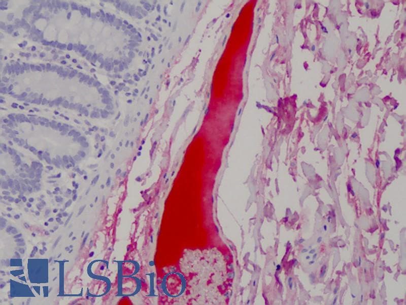 IHC-plus™ Monoclonal Mouse anti-Human CFH / Complement Factor H Antibody (clone OX-24, IHC, WB)
