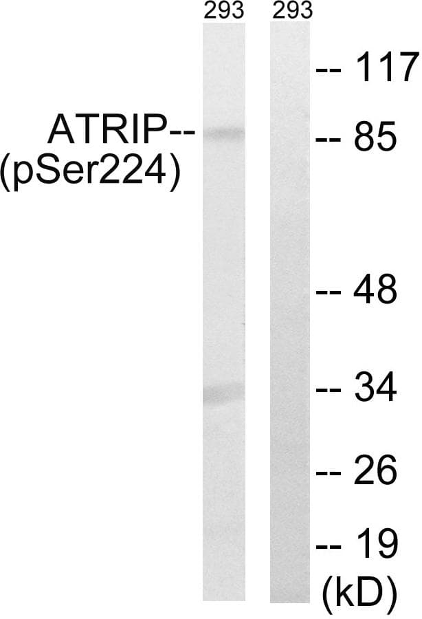 ATRIP Antibody (phospho-Ser224)