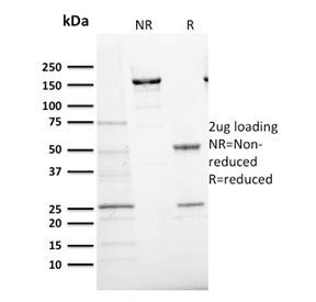 MKI67 / Ki67 Antibody (clone MKI67/2466)