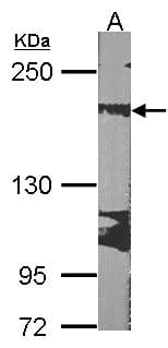 Polyclonal Rabbit anti-Human RRBP1 / hES Antibody (aa1183-1410, IHC, WB)