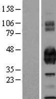 Human PROCR / EPCR Protein (Over-Expression Lysate Myc-DDK (Flag))