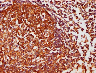 Polyclonal Rabbit anti-Human CSNK1D Antibody (IHC)