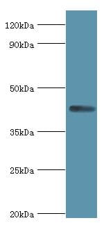 Polyclonal Rabbit anti-Human AIPL1 Antibody (aa1-384, IHC, WB)