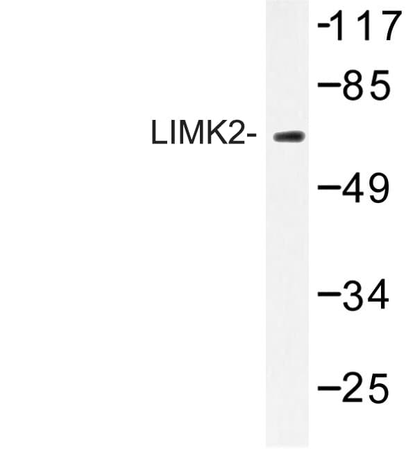 Polyclonal Rabbit anti-Human LIMK2 Antibody (Lys491, IHC, IF, WB)
