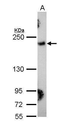 COL3A1 / Collagen III Antibody (aa1247-1389)