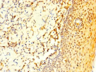 COL20A1 / Collagen XX Antibody