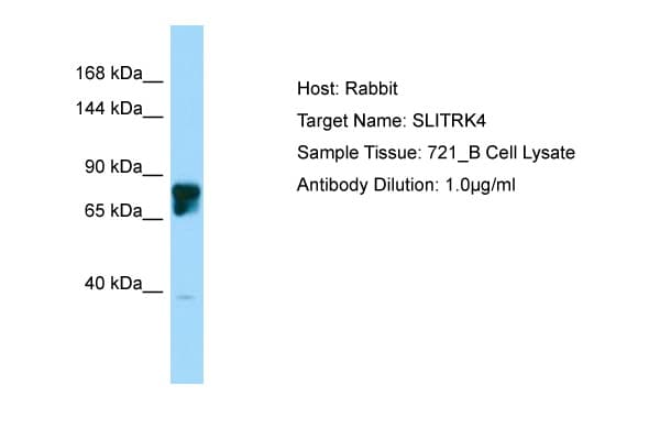 Polyclonal Rabbit anti-Human SLITRK4 Antibody (aa661-710, WB)