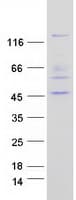 Human PTPN21 / PTPD1 Protein (Recombinant Myc-DDK (Flag))