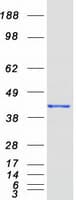 Human GNAI3 Protein (Recombinant Myc-DDK (Flag))