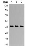 DMC1 Antibody